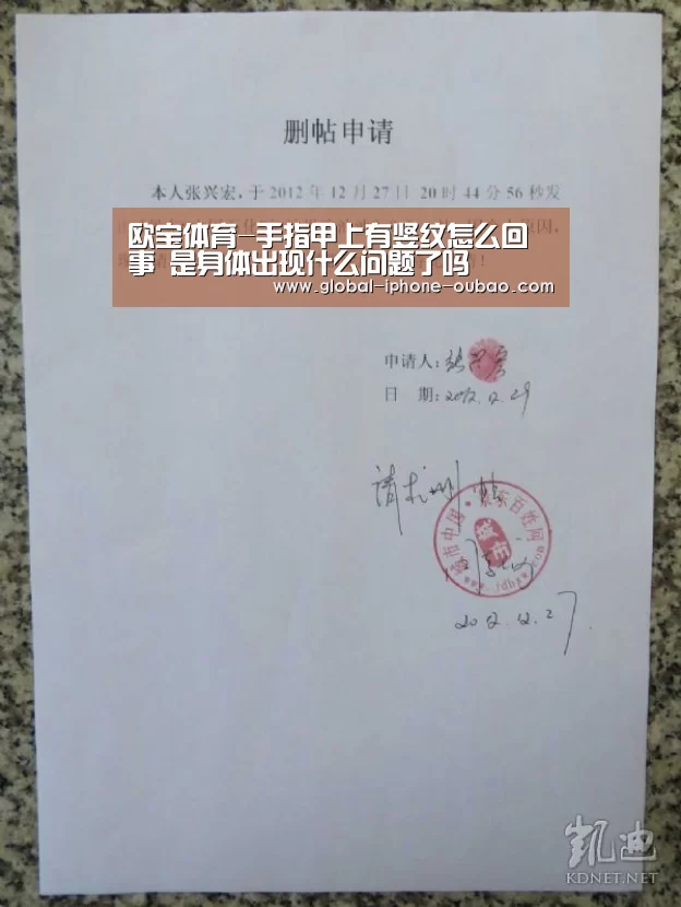 欧宝体育-手指甲上有竖纹怎么回事 是身体出现什么问题了吗(图1) 欧宝体育